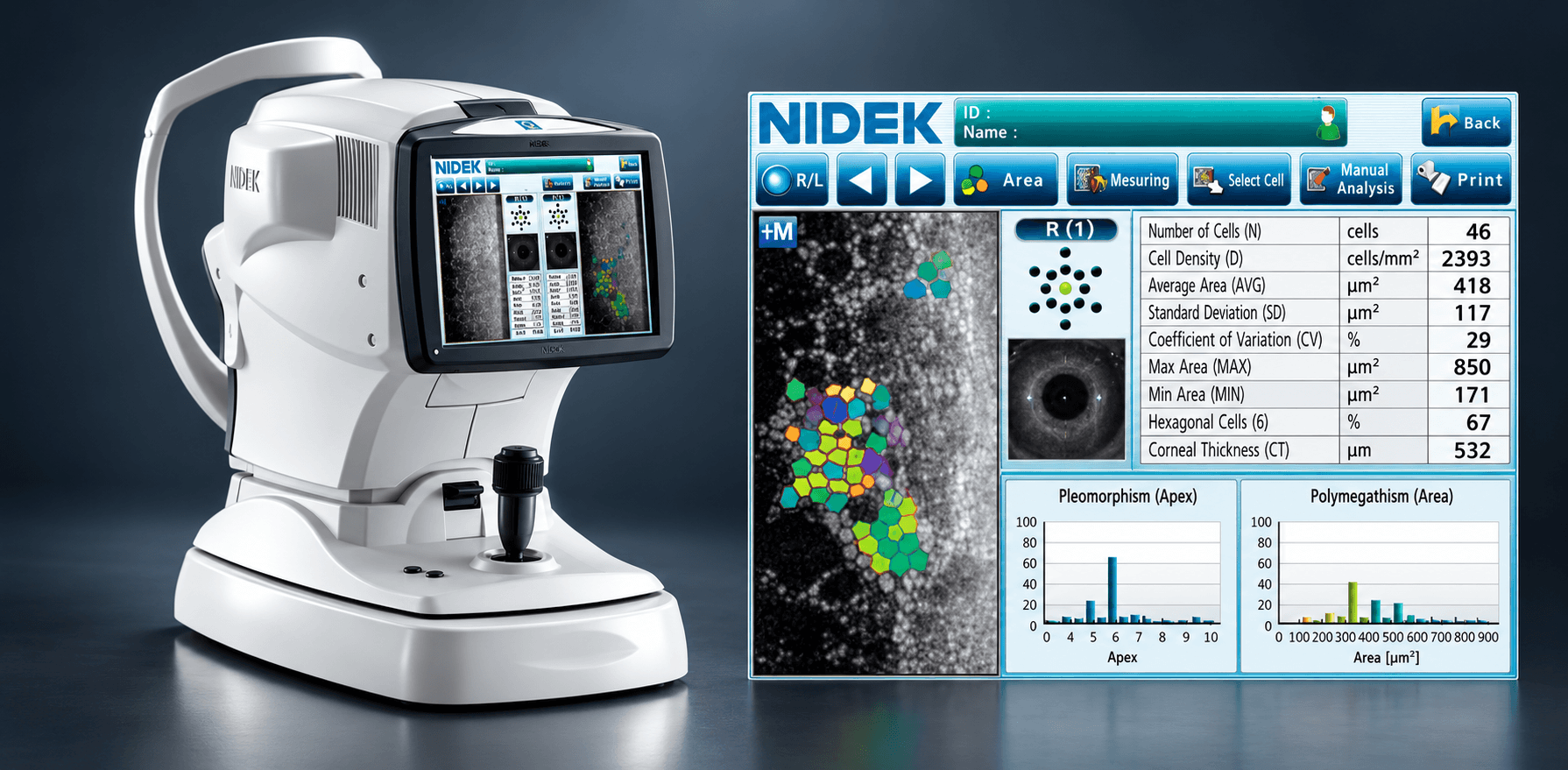 The Nidek CEM-530 specular microscope
